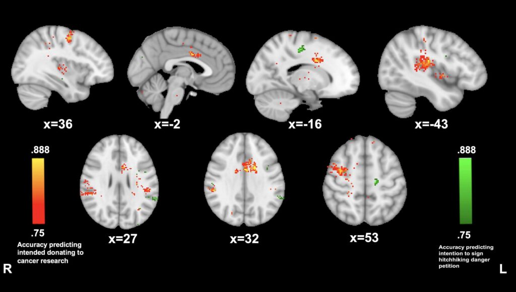 brain-scanning research by Zatorre